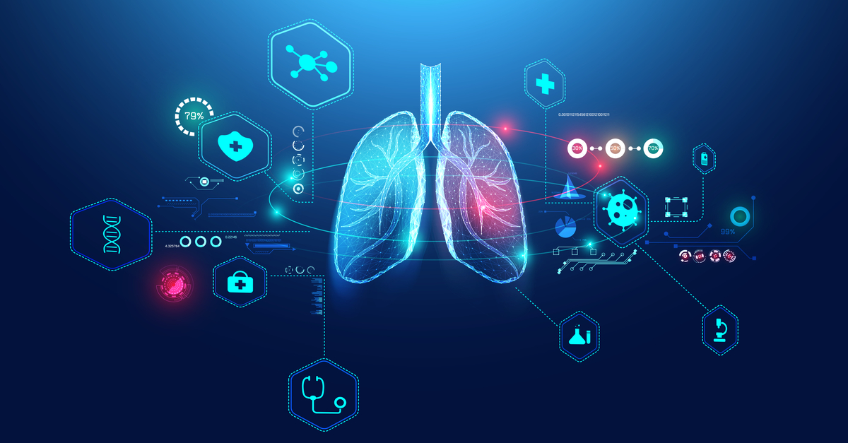 Endogenous DEL-1 restrains melanoma lung metastasis by limiting myeloid cell–associated lung inflammation